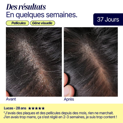 SHAMPOING SOLIDE ANTI-PELLICULAIRE · CHEVEUX & BARBE