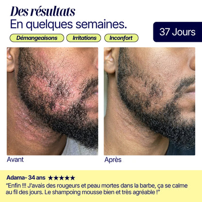 SHAMPOING SOLIDE ANTI-PELLICULAIRE · CHEVEUX & BARBE